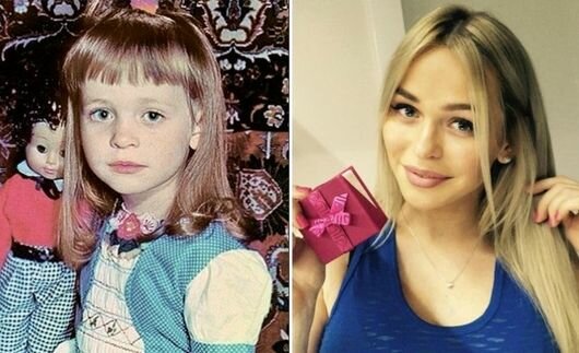 Anna Khilkevich before and after plastic surgery, height, weight, body parameters. Photo, biography