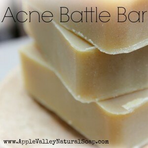 Acne Battle Bar | Apple Valley Natural Soap